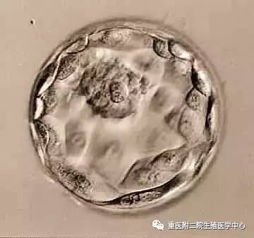 　囊胚宝宝